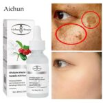 Arbutin Whitening Remove Freckle Face Serum Fade Dark Spots Melasma Melanin Fade Fine Lines Brightening Moisturizing Skin Care