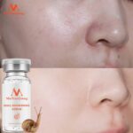 High Quality Snail Essence Hyaluronic Acid Liquid Whitening Spot Essence Shrink Pores Ampoule Anti-acne Regenerative Essence