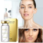 Face Filler Absorbable Collagen Protein Thread Carving Face Lift Plump Silk Fibroin Line Carving Anti Aging Essence