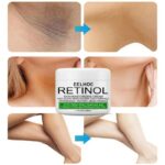 Body Whitening Cream For women Vagina Armpit Leg Butt Skin Lightening Remove Dark Expigment Body Bleaching Moisturizer