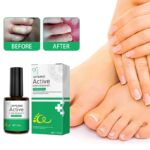 Effectively Remove Foot Corn Care Cream Remove Foot Calluses Remove Warts Smooth Skin Mild Wart Removal Corns Foot Care Solution