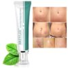 Scar Removal Cream Stretch Marks Removal Acne Scars Skin Repair Whitening Cream Dark Spot Remover For Face Skin Care