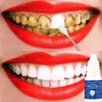 Teeth Whitening Gum Repair Teeth Cavities Filling Teeth Removal Plaque Stains Rot Yellowing Professional Dental Care OralHygiene