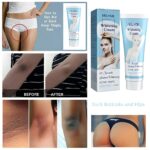 Whitening Cream Body Whitening Cream Eliminate Skin Melanin Whitening Legs Knees Private Parts Body Skin Lightening