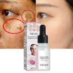 Whitening Freckle Face Serum Remove Dark Spots Brighten Skin Collagen Anti-wrinkle Hyaluronic Acid Moisturizer Beauty Skin Care