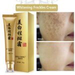 Whitening Freckles Cream Remove Dark Spot Face Cream Lighten Melasma Melanin Pigmentation Anti-Aging Moisturizing Brighten Skin