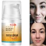 Bee Venom Honey Facial Cream Firming Lifting Skin Treatment Facial Cream Night Cream Anti Aging Wrinkles