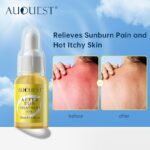 After Sun Gel Sunburn Care Cream After Sun Treatment Oil Facial Body Sunscreen Lotion Cream Skin Protective Moisturizing Oil