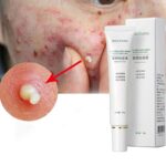 Effective Acne Removal Cream Tea Tree Acne Spots Oil Control Anti-aging Moisturizing Whitening Acne Cream Treatment SkinCare