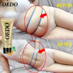 Acid Ginseng Slimming Cream Reduce Cellulite Lose Weight Burning Fat Slimming Cream Health Care Burning Creams