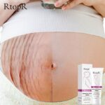 Pregnancy Scar Removal Cream Pregnant Women Pigment Correction Repair Body Gel Firming and Brightening Stretch Marks