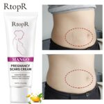 Pregnancy Scar Removal Cream Pregnant Women Pigment Correction Repair Body Gel Firming and Brightening Stretch Marks
