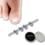 Professional Ingrown Toe Nail Correction Wire Fixer Treatment Tool Pedicure Patch Ingrown Toe Nail Correction Tool