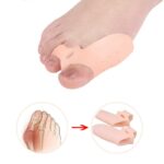 Silicone Bunion Corrector Toe Separators Foot Corrector Straightener For Toes Haluksy Calluses Pad Hallux Valgus Corrector