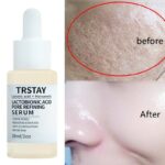 Lactobionic Acid Shrink Pores Serum Moisturizing Facial Essence Liquid Purify Pore Treatment Beauty Skin Care whitening cream
