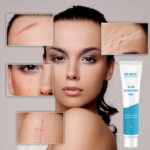Scar Removal Cream Scar Repair Gel Fade Scars Burn Caesarean Section Stretch Marks Acne Pits Acne Marks Surgical Scars