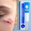 Scar Removal Cream Repairing Pregnancy Surgery Scars Fading Scars Smoothing Skin Scar Removal and Repairing Skin