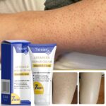 Repair Cream Moisturizing Improves Dry Rough Bulging Skin Treatment Keratosis Pilaris Smoothes Softens Skin Care