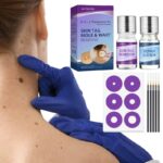 Wart Removal Kit Maximum Strength Painlessly Removes Plantar Wart Freeze Plantar Wart Remover For Feet Wart Stick Molluscum Wart