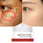 Whitening Freckle Face Cream Remove Dark Spots Melanin Melasma Remover Body Black Spots Elderly Spots Brightening Skin Care