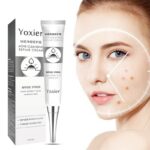 Acne Treatment Blackhead Remove Anti Acne Cream Whitening Shrink Pores Face Care Acne Scar Remove Oil Control Skin Care