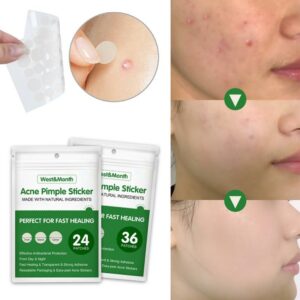 Waterproof Acne Pimple Patch Stickers Acne Treatment Pimple Remover Tool Invisible Breathable Acne Patch Skin Care 3