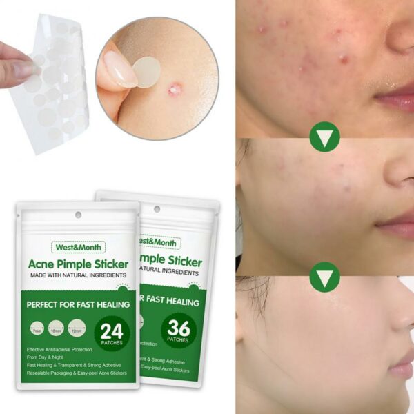 Waterproof Acne Pimple Patch Stickers Acne Treatment Pimple Remover Tool Invisible Breathable Acne Patch Skin Care 3