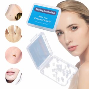 High Quality Micro Skin Tag Removal Rubber Bands Non Toxic Face Care Mole Wart Band Skin Care Beauty Tools 1