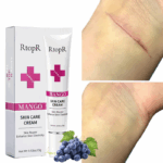 Skin Scar Removal Cream Face Fade Scars Cream Acne Spots Acne Treatment Blackhead Whitening Cream Anti Scar Stretch Marks Beauty