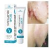 Scar Removal Cream Gel Repaire Pock Mark Burn Surgical Scar Cesarean Scar Stretch Mark Treatment Smooth Moisturize Skin Care 20g 1