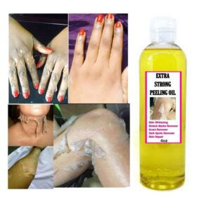 Yellow peeling oil strong yellow peeling oil Lighten elbows knees hands melanin even skin tone and whiten skin 1