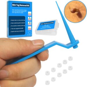 Blue Set Skin Tag Removal Kit Home Use Mole Wart Remover Equipment Micro Skin Tag Treatment Tool Easy To Clean Skin Care Tool 1