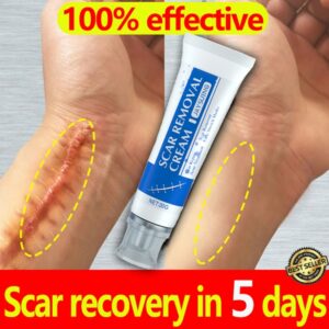 5-Day Recovery Scar Cream Fast Removal Skin Scars Treat Surgery Scars Stretch Marks Acne Pox Prints Burn Repair Facial Care Gel 1