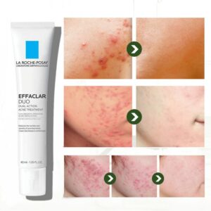 Effaclar Duo Whitening Acne Removal Cream Acne Spots Oil Control Acne Moisturizing Cream Face Skin Care 2