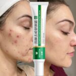 Effective Acne Removal Cream Treatment Acne Scar Shrink Pores Oil Control Whitening Moisturize Cream Face Gel Skin Care 2