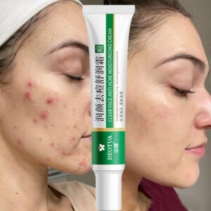 Effective Acne Removal Cream Treatment Acne Scar Shrink Pores Oil Control Whitening Moisturize Cream Face Gel Skin Care 2