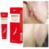 Scar Repair Cream Acne Remove Gel Fade Stretch Marks Acnes Spots Burn Surgical Scars Treatment Serum Smooth Body Skin Care 1