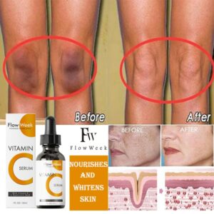 Flow Week Vitamin C Face Serum Whitening Anti Dark Spot Hyaluronic Acid Facial Essence Skin Care Nourishing Skin Beauty Health 1