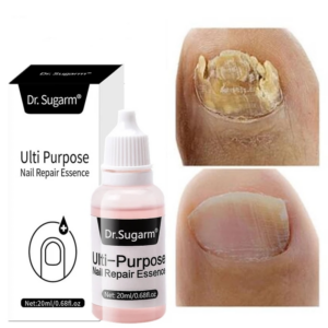 Nail Fungal Treatment Serum Paronychia Anti Infection Toe Fungus Hand Foot Onychomycosis Removal Repair Beauty Health