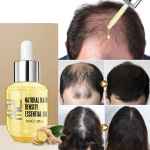 Ginger Hair Growth Products Prevent Hair Loss Essential Oil Fast Growing Scalp Treatment Beauty Health for Men Women