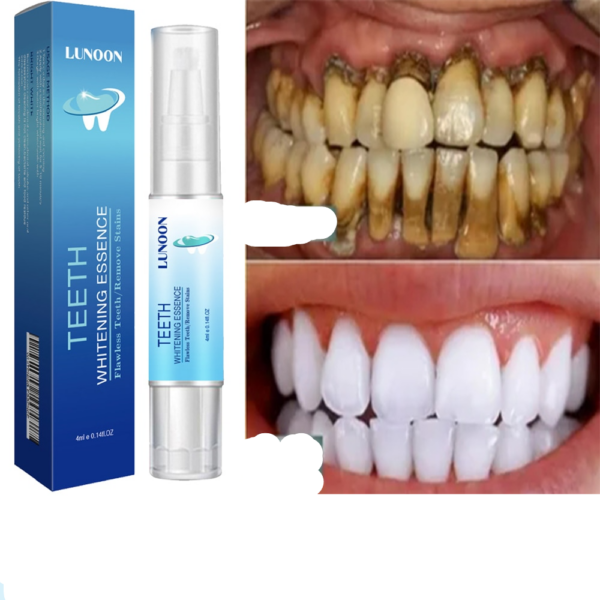 Teeth Whitening Pen Tooth Gel Whitener Bleach Remove Stains Instant Smile Teeth Whitening Kit Cleaning Serum Beauty Health