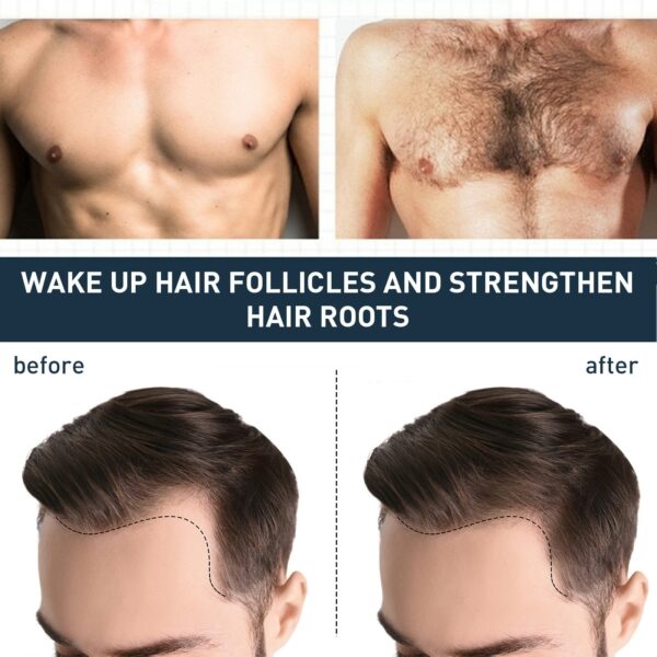 Men Styling Body Hair Growth Fluid Beard Chest Hair Fast Thick Growth Liquid Strong Repair Maintenance Hair Growth Enhancer Oil 1