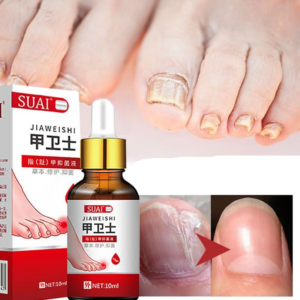 Nail Fungal Treatment Feet Care Essence Nail Foot Toe Nail Fungus Removal Oil Anti Infection Paronychia