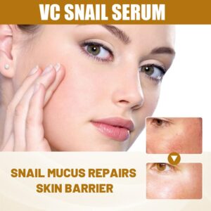 Anti Redness Soluation ,Spider Vein Removal Advanced treatment Clearer skin Veins on Face 1