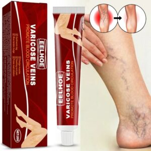 Relief Cream Leg Vasculitis Phlebitis Spider Pain Relief Ointment Herb Plaster Beauty Body Health Care 1