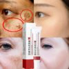 Whitening Freckle Cream Remove Dark Spots Anti Aging Cream Fade Pigmentation Melasma Brighten Serum Skin Care 1