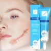 Scar Removal Repair Cream Stretch Marks Burn Acne Surgery Scar Cream Herbal Treatment Gel Whitening Beauty Health Care 1