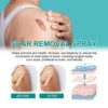 Scar Removal Spray Fade Scar Cream Gel /Repair Cream Removal Surgery Postpartum Stretch Mark Scar Treatment Smooth Skin 1
