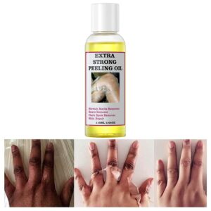 Yellow Peeling Oil Whitening Peeling Oil Lighten Elbows Knees Hands Melanin Even Skin Tone and Whiten Skin 1