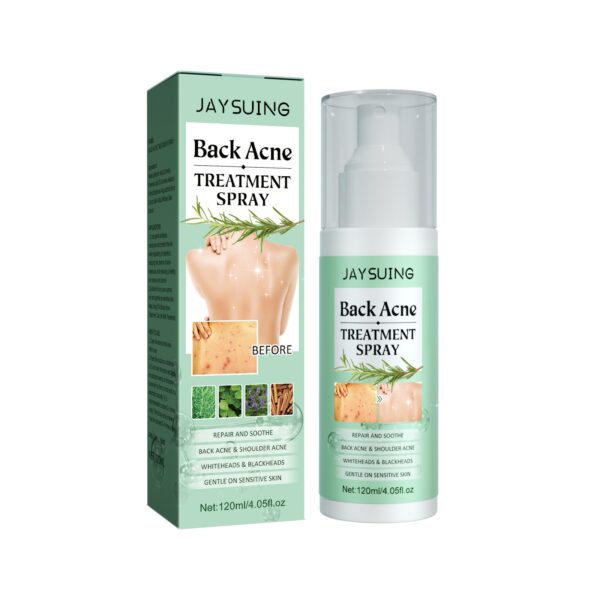 Acne Treatment Spray Face Anti Acne Marks Spot Removal Serum Oil Control Shrink Pores Moisturizing Salicylic Acid Skin Care 1